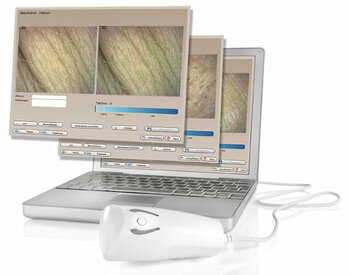 Professionele huidanalyse