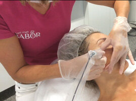 De aanpak voor een zichtbare huidverbetering. Microneedling.